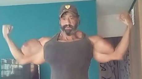 Muere en el día de su cumpleaños el ‘Hulk’ brasileño que se inyectaba Synthol para inflar los músculos